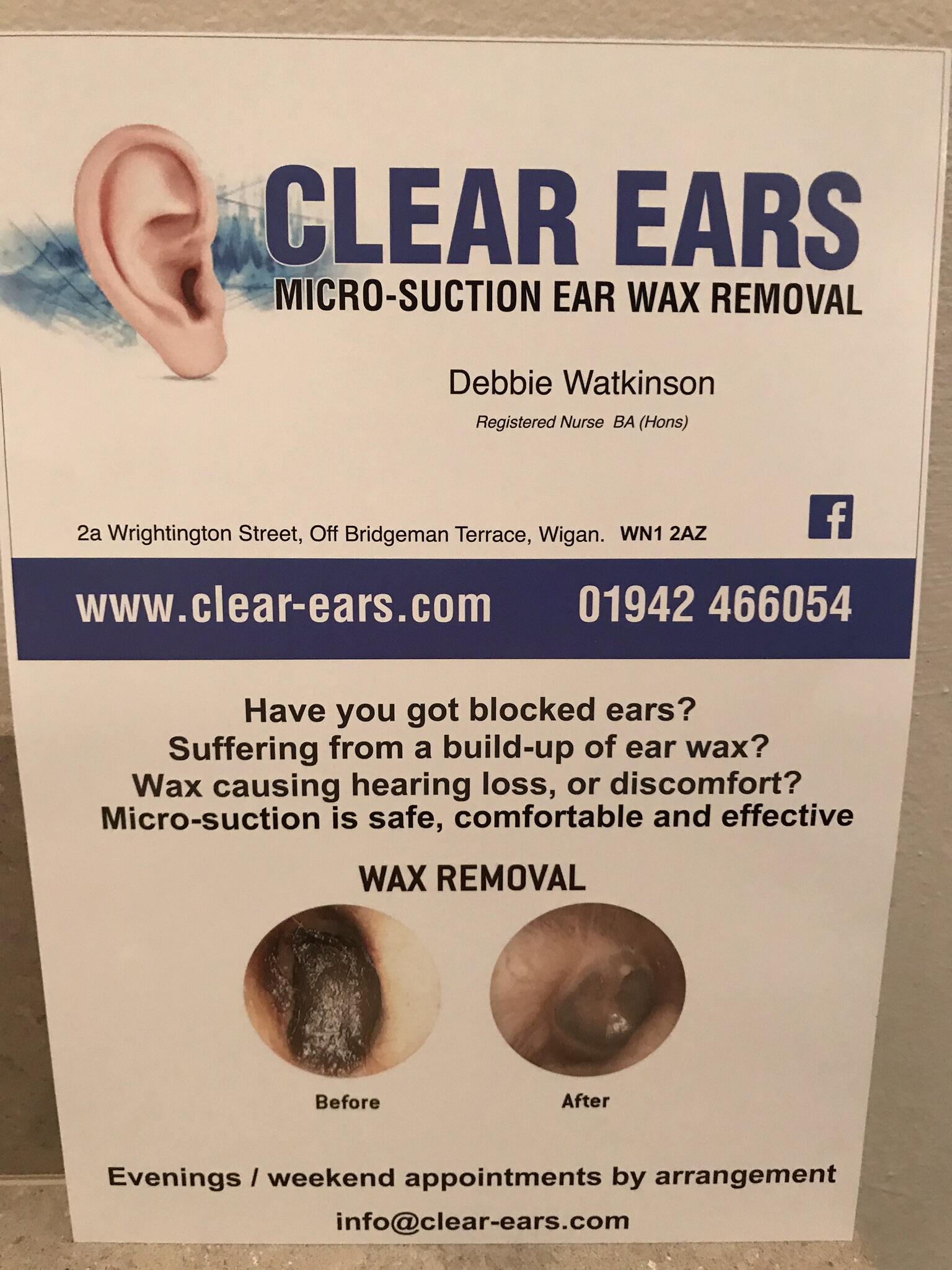 Clear Ears Ear Wax Removal Wigan Nextdoor