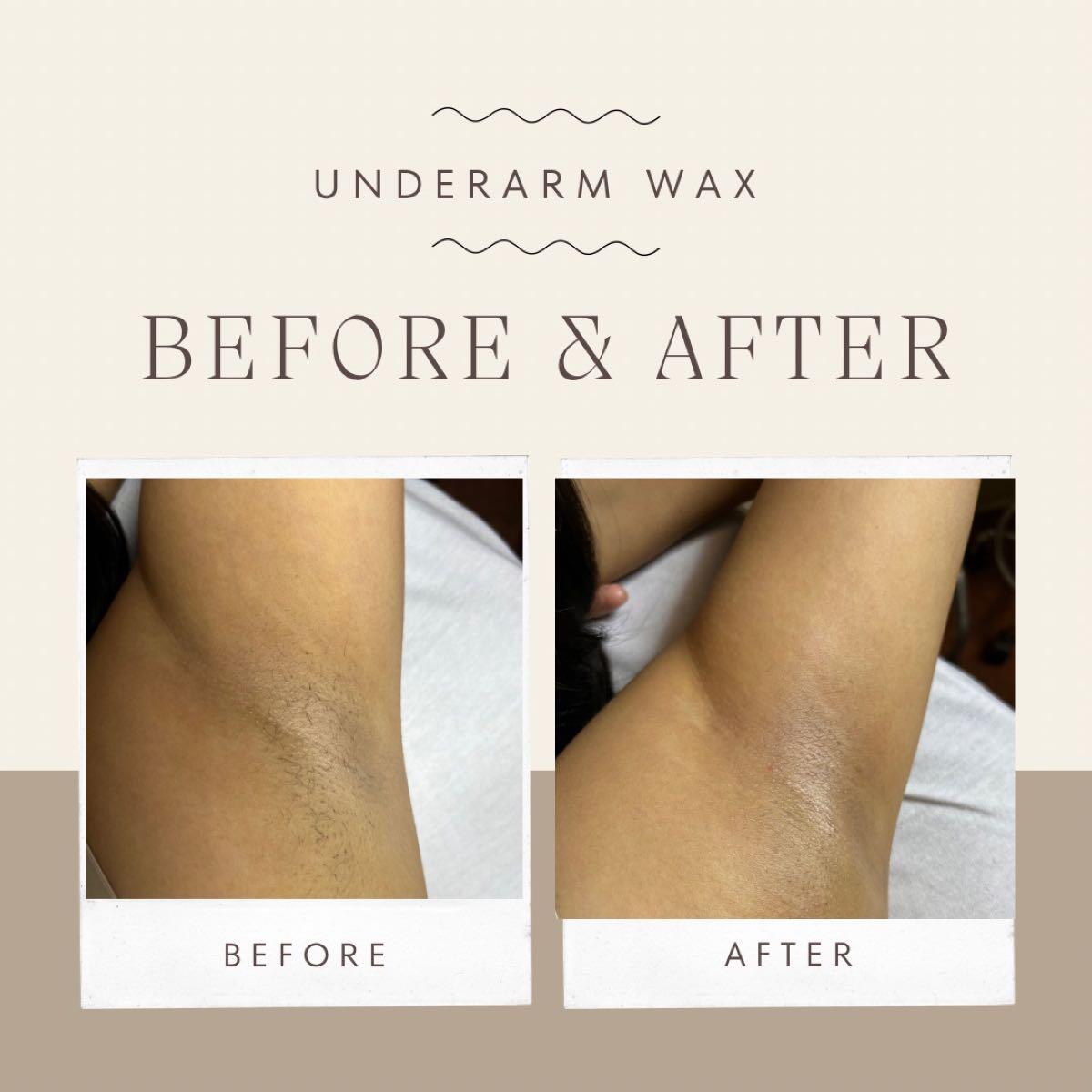 underarm waxing before and after