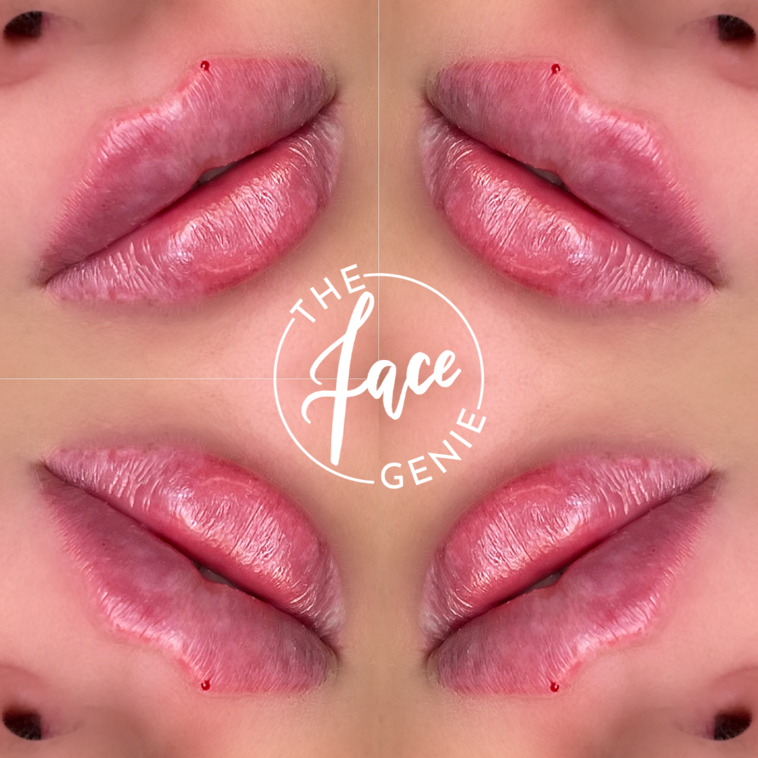 The Face Genie Aesthetics Waltham Cross, GBENG Nextdoor