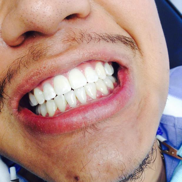 5280 Teeth Whitening Denver, CO Nextdoor