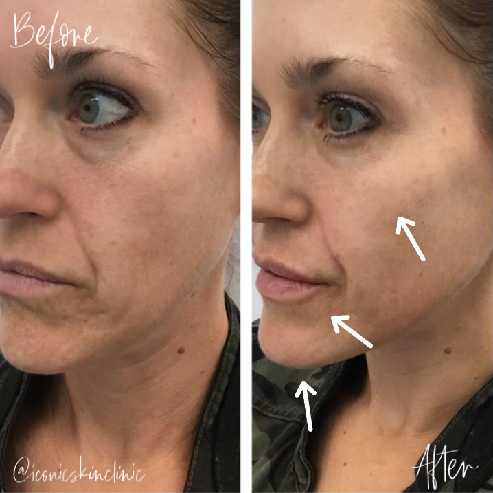 Iconic Skin Clinic La Mirada, CA Nextdoor