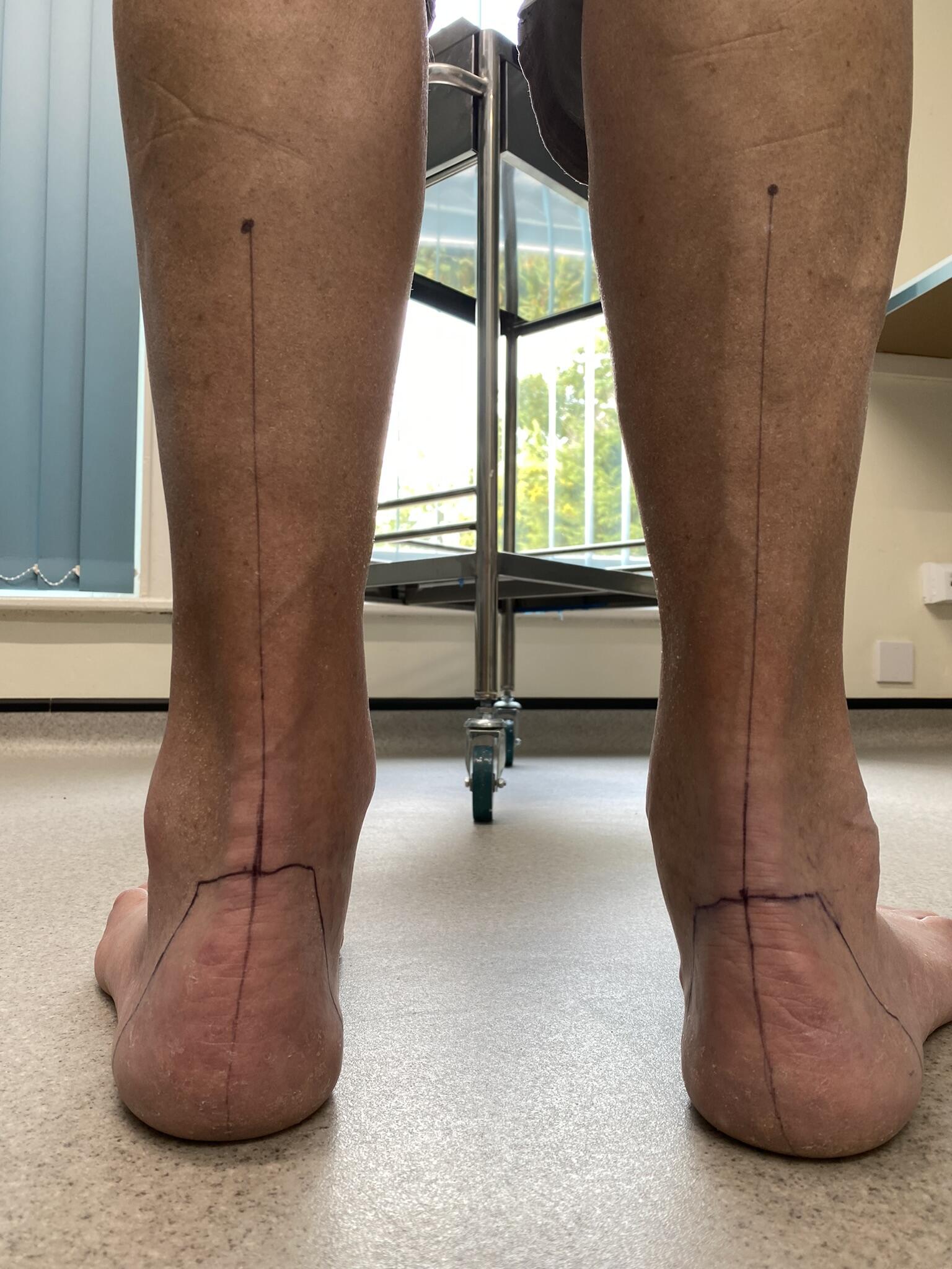 Feet Beyond Lincoln Nextdoor