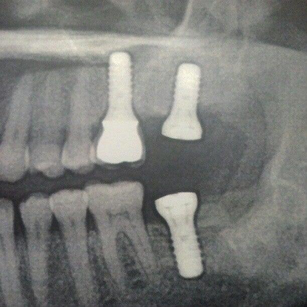 The Maryland Center for Oral Surgery and Dental Implants Cockeysville