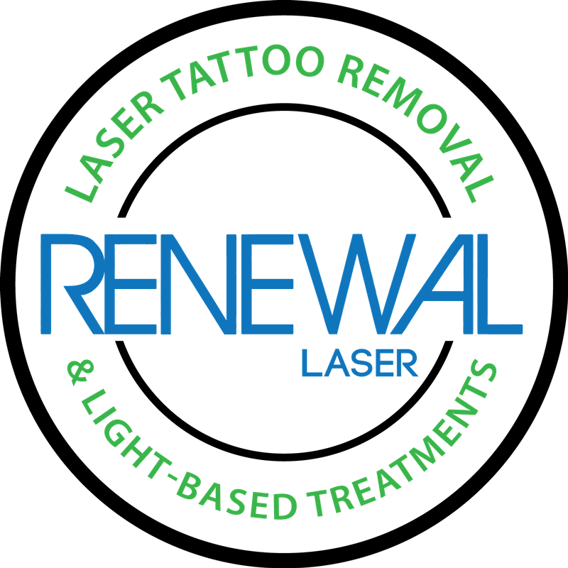 Does Tattoo Removal Really Work  SDBotox  Tattoo Removal
