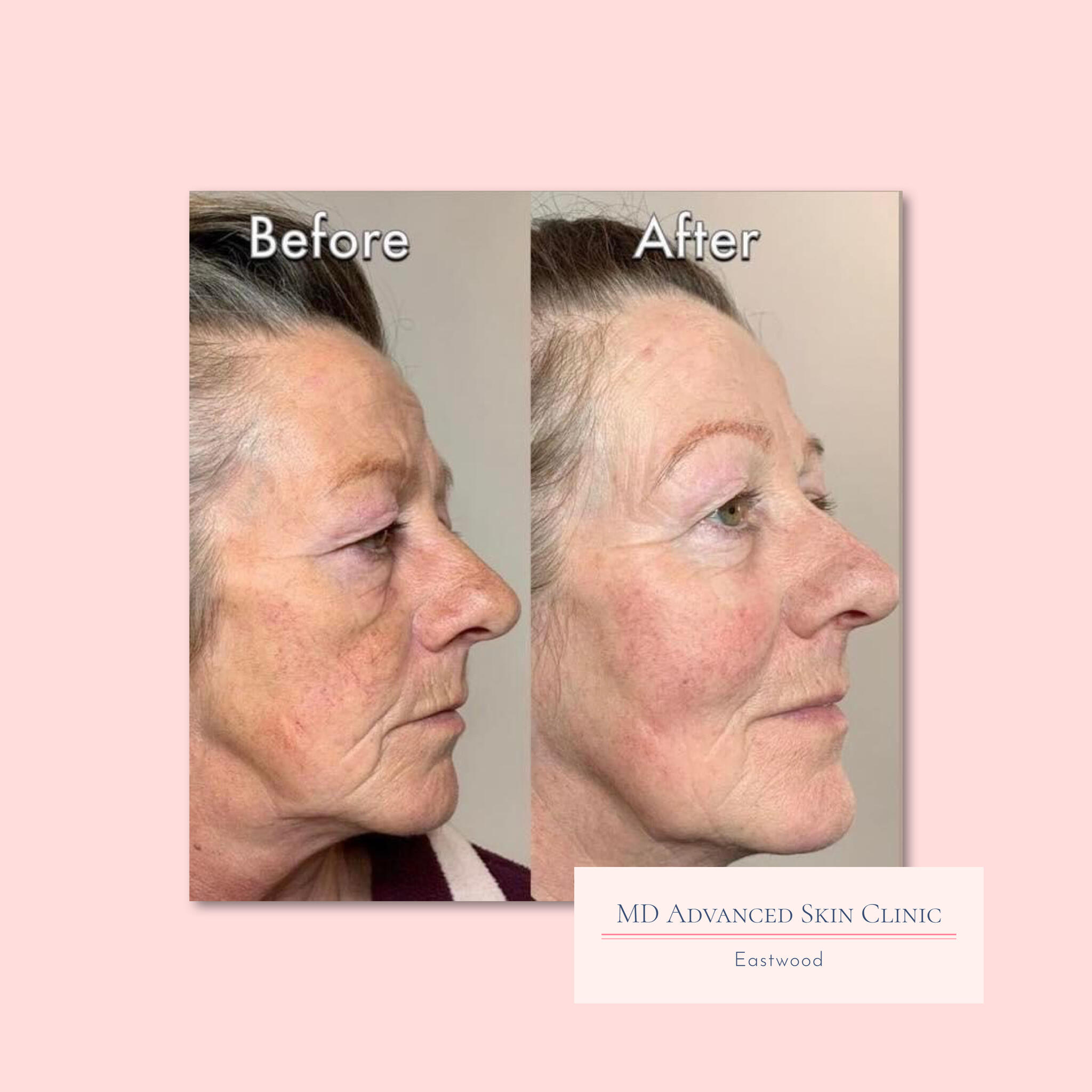 MD Advanced Skin Clinic The Eastwood Retreat Nottingham Nextdoor