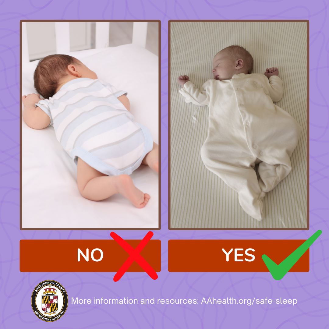 Sudden Infant Death Syndrome (SIDS) is the third leading cause of death