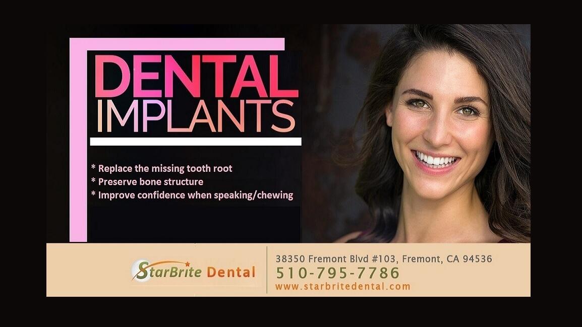 Starbrite Dental Fremont CA Nextdoor